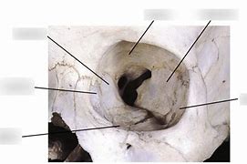 Image result for Orbital Bone Anatomy Model