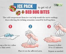 Image result for Benedryl Bug Bites