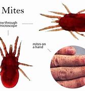 Image result for Red Bird Mites