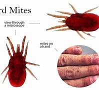 Image result for Bird Nest Mites