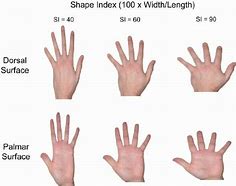 Image result for Dorsal Aspect Hand