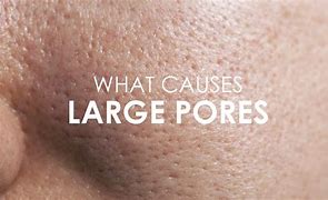 Image result for Skin Pores Up Vlose