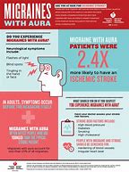 Image result for Migraine with Aura Stroke