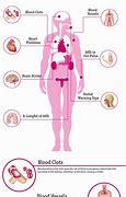 Image result for Atrial Fibrillation On the Body