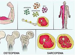 Image result for MSM Bone Monstetr