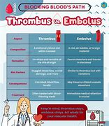 Image result for What Is a Thrombus