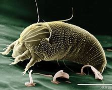 Image result for Mite Size