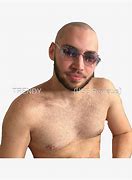 Image result for Adin Ross Balding