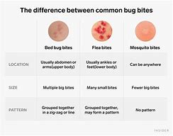 Image result for Bed Bug Bites Groin