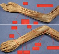 Image result for Wrist Muscles