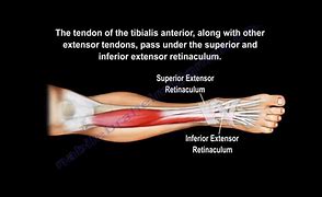 Image result for A Tibialis Ant