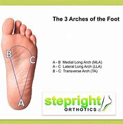 Image result for 3 Arches of the Foot