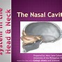 Image result for Arteries of Nasal Cavity