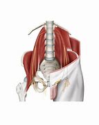 Image result for Ilioinguinal Nerve Pain Syndrome