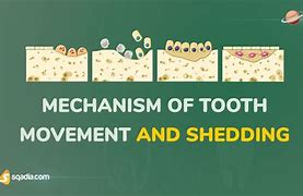 Image result for Propel Tooth Movement