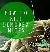 Image result for Killing Demodex Mites On Face