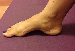 Image result for Foot Arch Images