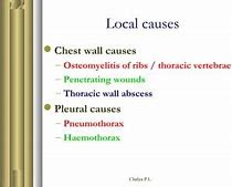 Image result for Thoracic Empyema On Percussion