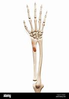 Image result for Extensor Pollicis Brevis