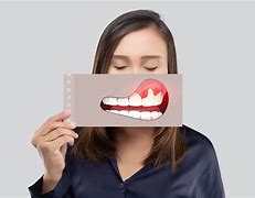 Image result for Infectie Dentara