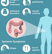 Image result for Colon Cancer Symptoms in Men Signs