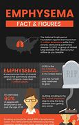 Image result for Emphysema