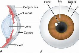 Image result for Limbus Cornea