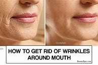 Image result for How to Remove Wrinkles around Mouth