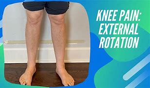 Image result for Lateral Knee Pain with Internal Rotation