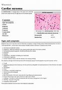 Image result for Cardiac Myxoma