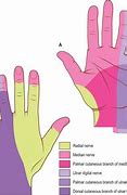 Image result for Volar Aspect Finger