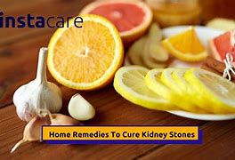 Image result for Kidney Stone Remedy