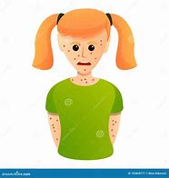 Image result for Pox Baby Girl