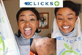 Image result for Hard Skin Remover On Hands Clicks