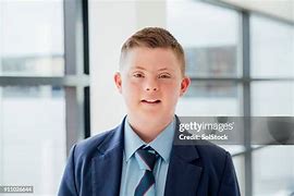 Image result for Boy Down S Syndrome