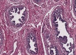 Image result for Human Tissue Acyt