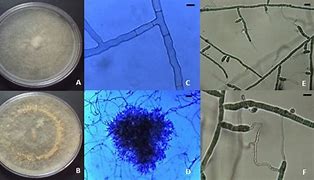 Image result for Rhizoctonia Solani Microscopic View