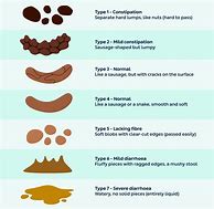 Image result for Know Your Poop Chart