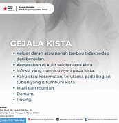 Image result for Kista Adalah