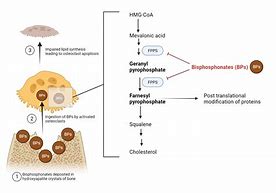 Image result for Bisphosphonate