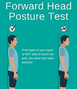 Image result for Head and Neck Posture