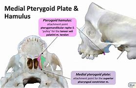 Image result for Pterygoid Plate