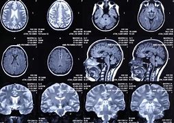 Image result for IRM Cerveau