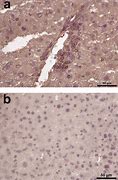 Image result for CD4 Liver