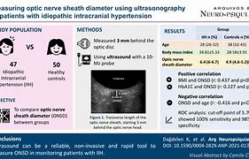 Image result for Enlarged Optic Nerve