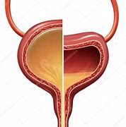 Image result for Normal Bladder