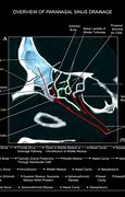 Image result for Infundibulum Nose