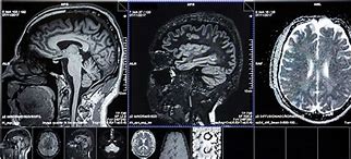 Image result for CT Scan Views