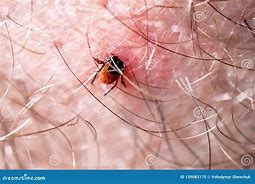 Image result for Mites Under Skin