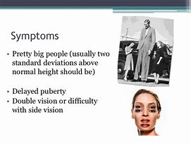 Image result for Example of Gigantism